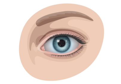 Корисна інформація: Синдром сухого глаза: причины и лечение