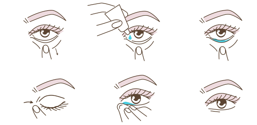 Корисна інформація: Синдром сухого глаза: причины и лечение