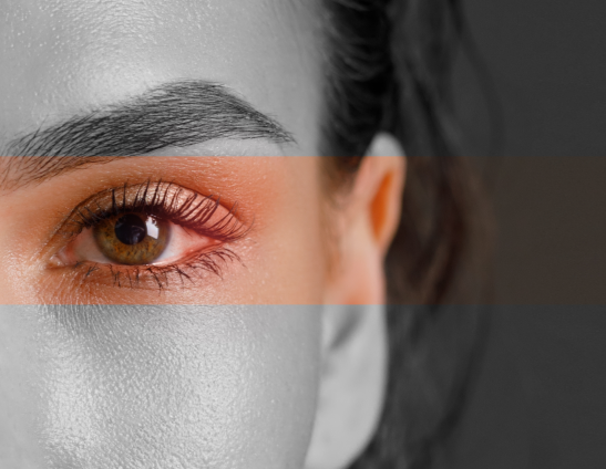 Корисна інформація: Аллергия и синдром «сухого глаза»